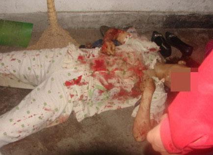 Ѫ�Ȍ�(sh��)�ģ�����Ů�Ӛ�����Ԛ��F(xi��n)��(ch��ng)(�M�D)