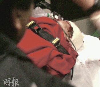 81�q�����N��76�q����(�D)