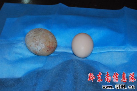 ���׽Yʯ���u���� ���˶��е��@Ӡ���D��