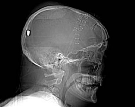 Ӣ���˱��������д��X�o(w��)��ȡ�� ���E���