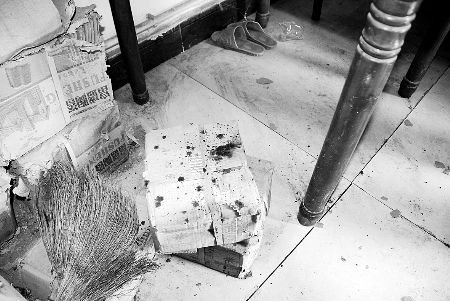 84�q�����������Ժ �첲����Ѫ��������(�D)