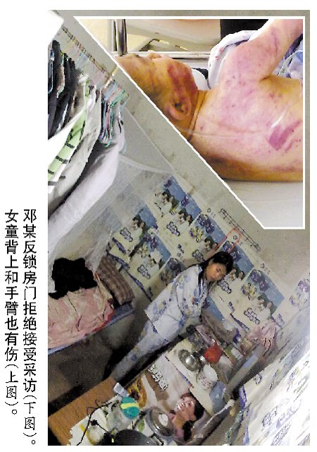 ��Ű��3�qŮͯ ��������X��Ѫ���ڱ�؃�