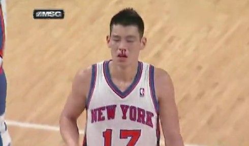 �����r�g2012��3��1�գ�NBA��Ҏِ���˹����Tʿ����ِ�M�е���һ��߀��2�ֶ�犣��֕�����һ�λ�픠���r�����o��Ŀ�˹��������ǿף��D�r��Ѫֱ����ֻ������Ϣ���ɴ��S˹�ǈ��M����