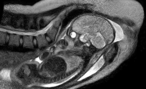 �����ú˴Ź�������ĳ�ȫ�����׋냺�����DƬ