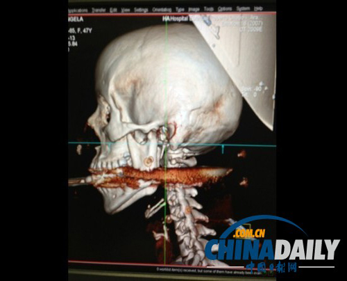 һ������Ů�ӱ��~(y��)���`������У����x����H1���������E����߀��